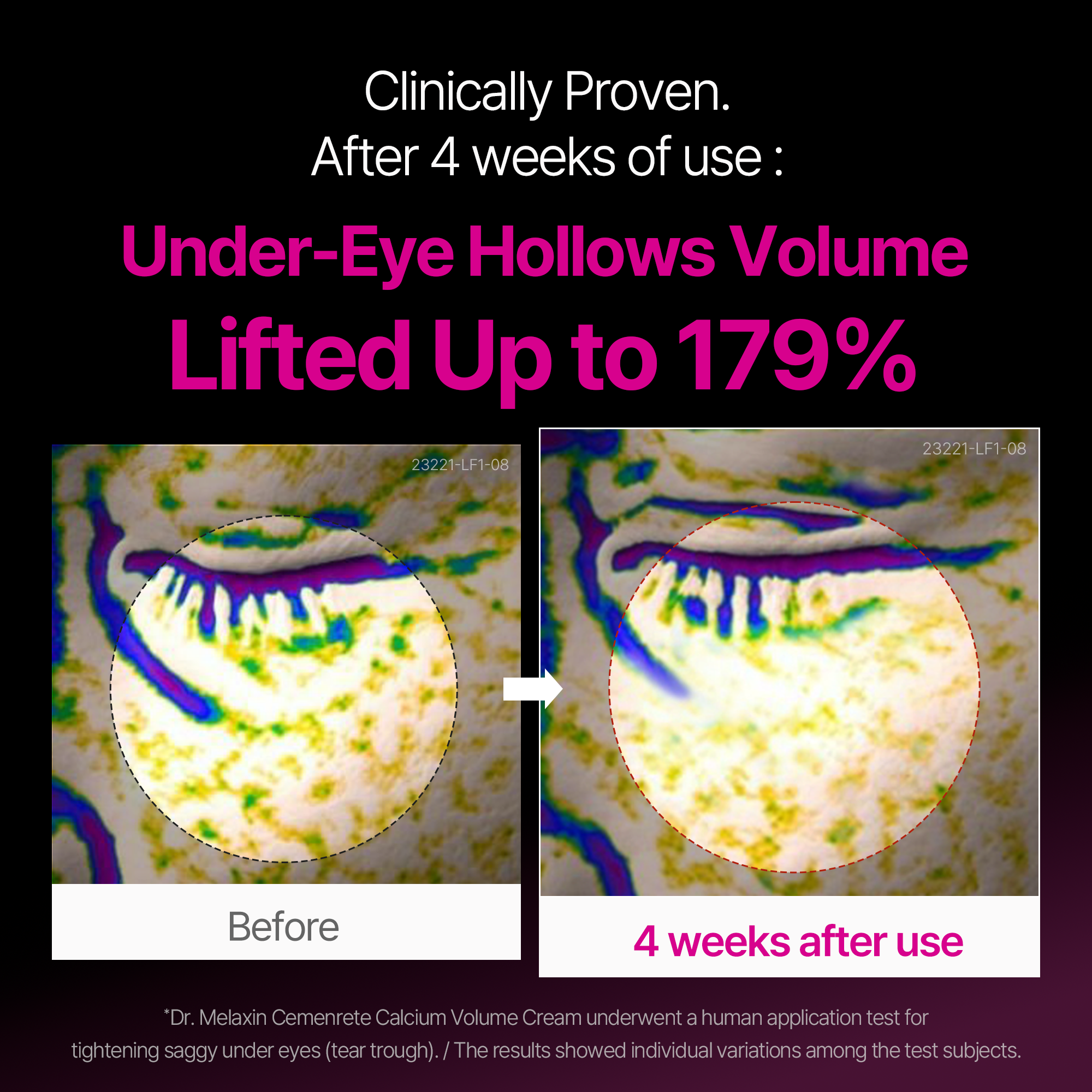 Cemenrete Calcium Eyecare Routine - Image 3